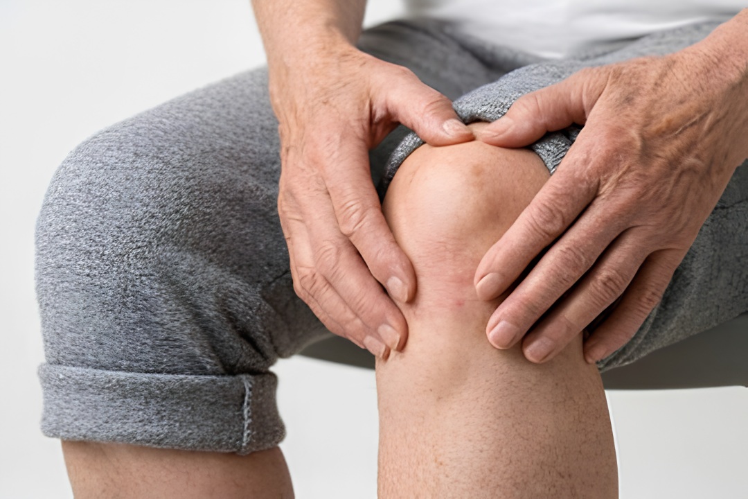 Knee Osteoarthritis